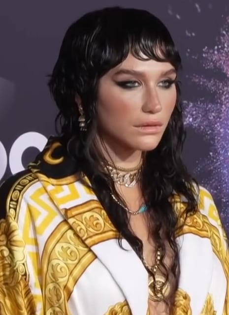 Photo of Kesha